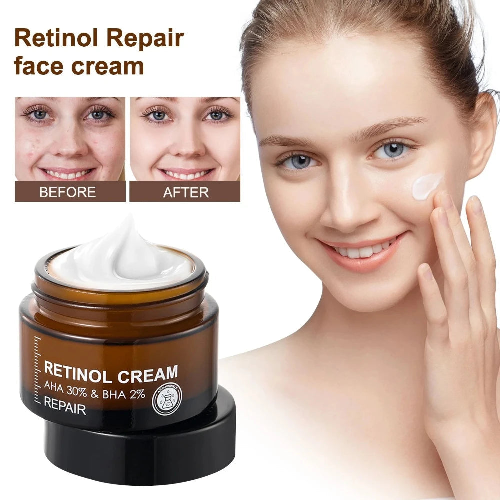 Retinol Anti-Wrinkle Moisturizer